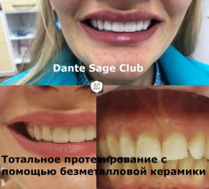 Эстетическая стоматология Москва
